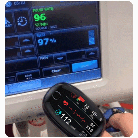 🔥 Huge 50% Discount 🔥 Non-invasive Blood Glucose Monitoring Device